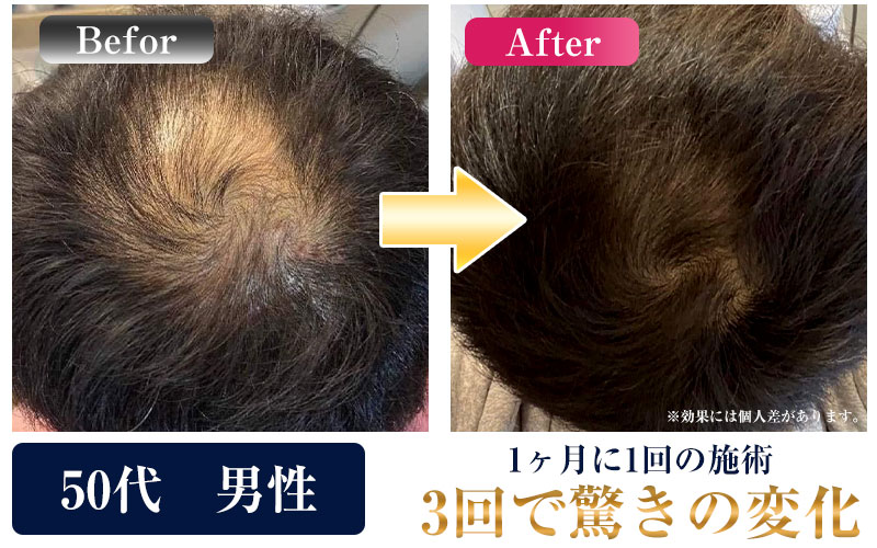 ビフォーアフター