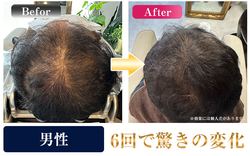 ビフォーアフター