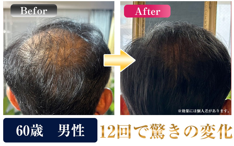 ビフォーアフター